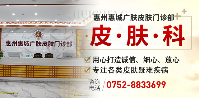 惠州广肤专科